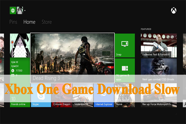 Xbox One Game Download Slow? – Quickly and Easily Fix It
