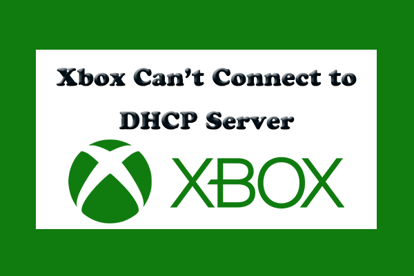 [Solved] Xbox Can’t Connect to DHCP Server