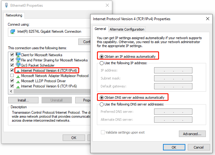 make Network obtain IP address and DNS server address automatically