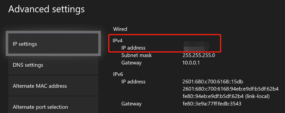 check IP Settings Xbo